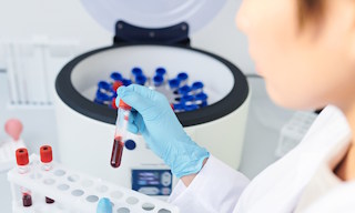 Лабораторные исследования и замеры под ключ в Одинцове в октябре